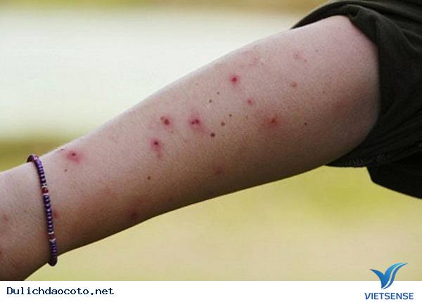 Phòng tránh đối với muỗi - Ảnh 2